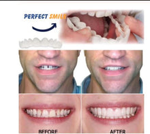 Load image into Gallery viewer, Perfect Smile Instant False Teeth