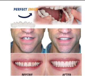 Perfect Smile Instant False Teeth